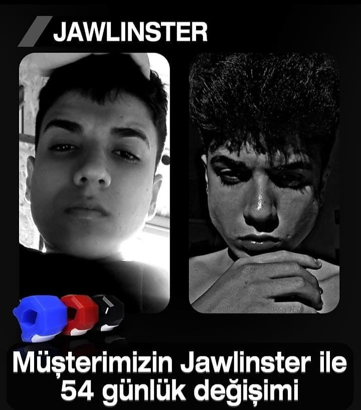 Jawlinster kullanım görseli 3