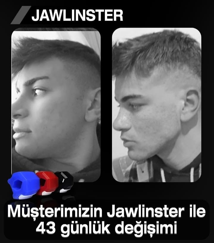 Jawlinster kullanım görseli 4
