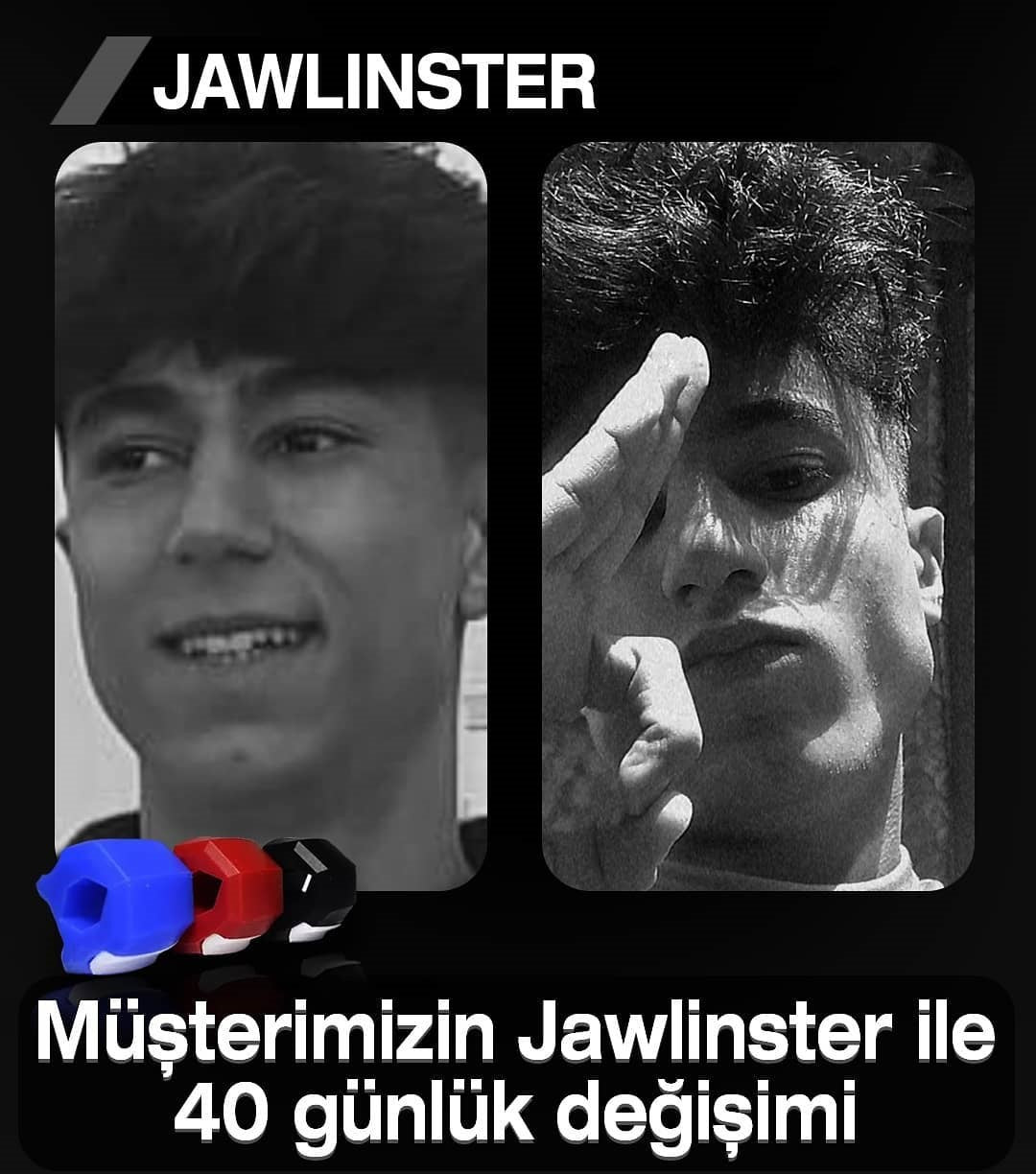 Jawlinster kullanım görseli 1